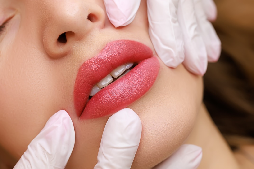 Conheça mais sobre o preenchimento labial